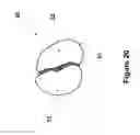 Fig. 20 - Methods, systems, and devices for detecting and identifying microorganisms in microbiological culture samples
