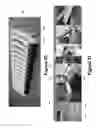 Fig. 30 - Methods, systems, and devices for detecting and identifying microorganisms in microbiological culture samples