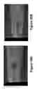 Fig. 49 - Methods, systems, and devices for detecting and identifying microorganisms in microbiological culture samples