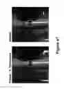 Fig. 60 - Methods, systems, and devices for detecting and identifying microorganisms in microbiological culture samples