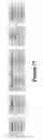 Fig. 64 - Methods, systems, and devices for detecting and identifying microorganisms in microbiological culture samples