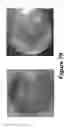 Fig. 72 - Methods, systems, and devices for detecting and identifying microorganisms in microbiological culture samples