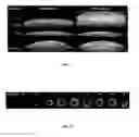 Fig. 07 - Liquid diagnostic assays utilizing marangoni flow