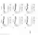 Fig. 02 - Genetically stable live attenuated respiratory syncytial virus vaccine and its production