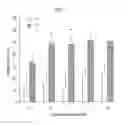 Fig. 02 - Oligonucleotide, glucocorticoid sensitivity enhancer, pharmaceutical composition, and expression vector