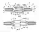 Fig. 02 - Coaxial cable and connector with capacitive coupling