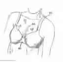 Fig. 01 - DECOLLETAGE-SHAPING BRASSIERE
