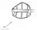 Fig. 01 - Batter assist power trainer device