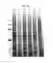 Fig. 64 - Phosphine derivatives of fluorescent compounds