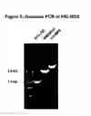 Fig. 06 - Mutant ROS expression in human cancer