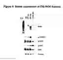 Fig. 07 - Mutant ROS expression in human cancer