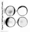Fig. 08 - Mutant ROS expression in human cancer