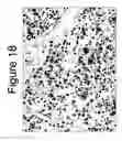 Fig. 20 - Mutant ROS expression in human cancer