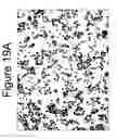 Fig. 21 - Mutant ROS expression in human cancer