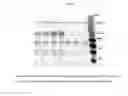 Fig. 02 - PROLYL HYDROXYLASE INHIBITORS AND METHODS OF USE