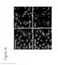 Fig. 20 - Methods of detecting Akt3 and administering Ax1 inhibitor