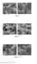 Fig. 04 - Synthesis of crystalline molecular sieves having the EUO framework type