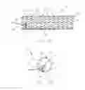 Fig. 02 - INTRAVASCULAR DEVICE ATTACHMENT SYSTEM HAVING BIOLOGICAL MATERIAL