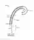 Fig. 34 - System for robotic-assisted endolumenal surgery and related methods