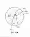 Fig. 57 - System for robotic-assisted endolumenal surgery and related methods