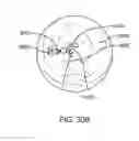 Fig. 58 - System for robotic-assisted endolumenal surgery and related methods