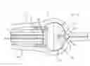 Fig. 01 - Balloon access device with features for engaging an endoscope