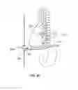Fig. 09 - Articulating cannula access device