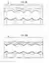 Fig. 37 - In vivo camera with multiple sources to illuminate tissue at different distances