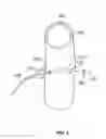 Fig. 08 - Laparoscopic lead implantation method