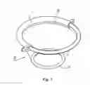 Fig. 02 - Wound protector