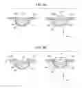 Fig. 05 - SUBJECT-INFORMATION ACQUIRING APPARATUS