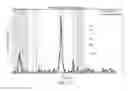 Fig. 22 - MR SPECTROSCOPY SYSTEM AND METHOD FOR DIAGNOSING PAINFUL AND NON-PAINFUL INTERVERTEBRAL DISCS