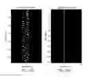 Fig. 24 - MR SPECTROSCOPY SYSTEM AND METHOD FOR DIAGNOSING PAINFUL AND NON-PAINFUL INTERVERTEBRAL DISCS