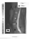 Fig. 41 - MR SPECTROSCOPY SYSTEM AND METHOD FOR DIAGNOSING PAINFUL AND NON-PAINFUL INTERVERTEBRAL DISCS