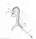 Fig. 01 - NON-INVASIVE EVALUATION OF FIT AND SIZING OF DEVICE PRIOR TO IMPLANT