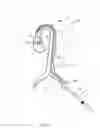 Fig. 03 - NON-INVASIVE EVALUATION OF FIT AND SIZING OF DEVICE PRIOR TO IMPLANT