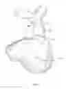 Fig. 05 - NON-INVASIVE EVALUATION OF FIT AND SIZING OF DEVICE PRIOR TO IMPLANT