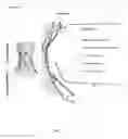 Fig. 07 - NON-INVASIVE EVALUATION OF FIT AND SIZING OF DEVICE PRIOR TO IMPLANT