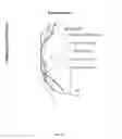 Fig. 08 - NON-INVASIVE EVALUATION OF FIT AND SIZING OF DEVICE PRIOR TO IMPLANT