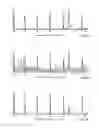 Fig. 09 - Heartbeat categorization
