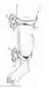 Fig. 01 - Protective limb wrap