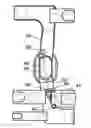 Fig. 01 - Orthotic strapping system