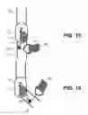 Fig. 08 - Orthotic strapping system