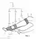 Fig. 04 - Apparatus having brace assembly for muscle