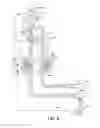 Fig. 08 - Fluid management system and methods