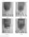 Fig. 02 - OPTIMIZING UNGUAL TREATMENT BY QUANTITATIVE AUTORADIOGRAPHY