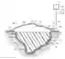 Fig. 01 - Wound dressing with vacuum reservoir