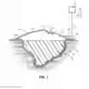 Fig. 02 - Wound dressing with vacuum reservoir
