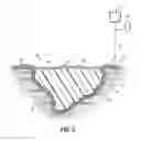 Fig. 03 - Wound dressing with vacuum reservoir