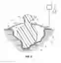 Fig. 05 - Wound dressing with vacuum reservoir